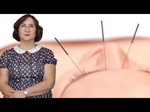 Akupunktur Nedir? Sağlığımız için Neden Önemli? - Uzm. Dr. Fulya Tarhan