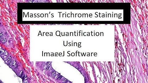 How to Measure different Colored Area in Images Using Image J Software