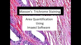 How to Measure different Colored Area in Images Using Image J Software screenshot 3