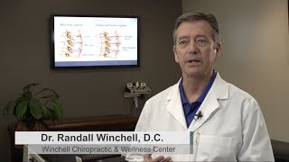 Bone Spurs Winchell Chiropractic & Wellness Center