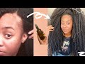 😲RESULTS IN 2 DAYS!!!! USE THIS!! HEALTHIEST SCALP, MASSIVE HAIR GROWTH & REGROWTH🤯