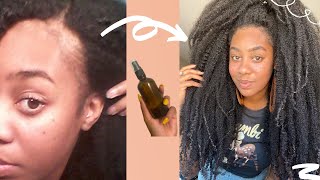 RESULTS IN 2 DAYS!!!! USE THIS!! HEALTHIEST SCALP, MASSIVE HAIR GROWTH & REGROWTH?