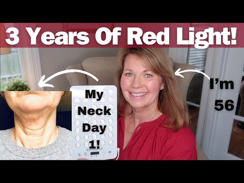 Let Me Show You My Results From Using Red Light For 3 Years!!