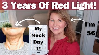 Let Me Show You My Results From Using Red Light For 3 Years!!