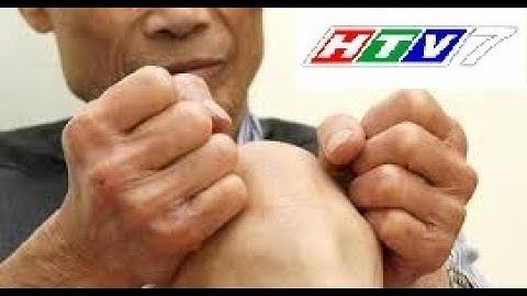 Đau nhức xương khớp toàn thân | Triệu chứng, nguyên nhân và cách điều trị  | ACC