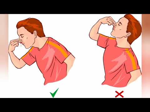 اتصرف ازاي لو جالي نزيف من الانف او في البول او كدمات تحت الجلد و انا باخد دواء السيولة الماريفان