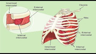 Intercostal Muscle Strain