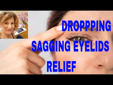#masaj #eyelid Masaj Cum Scapam De Pleoapele Lasate?MASAJ