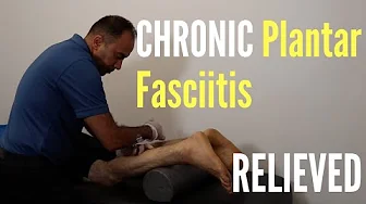 CHRONIC * Plantar Fasciitis * Relieved With ASTR (REAL TREATMENT!!!!)