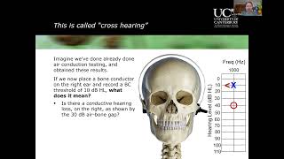 Clinical Masking in Audiology - A Beginner's Guide