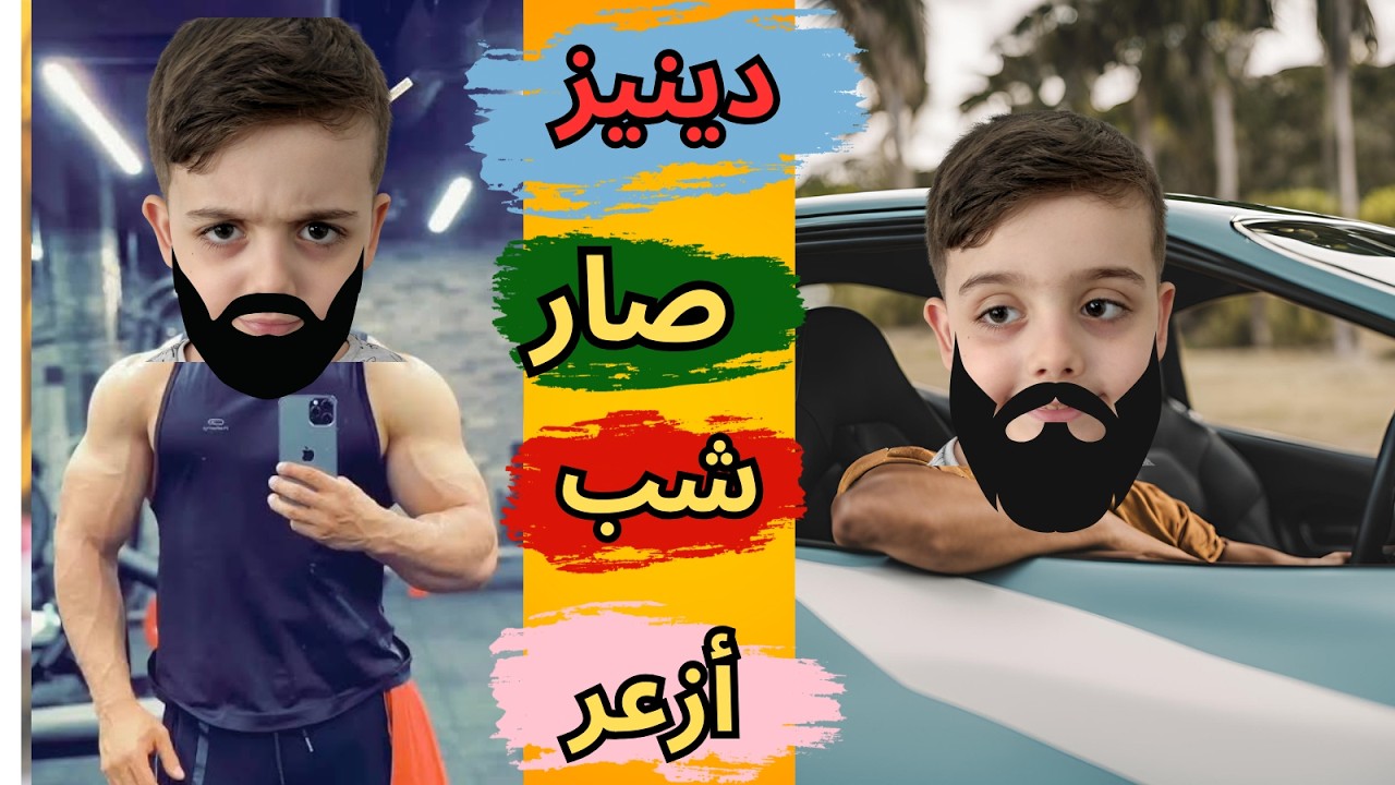 دينيز صار شب بعمر ال٢٠ سنة 😱 طلع أزعر وعمل مشاكل وعذبنا😥