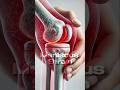 Knee Pain in Dancers Explained | Causes, Prevention &amp; When to Worry | Dr.sindhuja | Chennai
