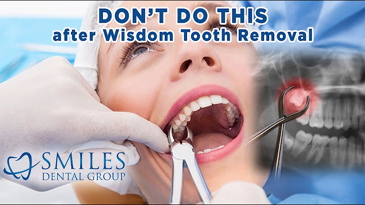 Dentist for wisdom teeth removal near me