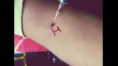 INFESTED -👿Living with parasites👿