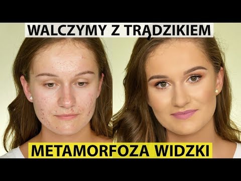 Wideo: 20 Gwiazd, Które Nie Ukrywają Trądziku