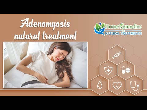Video: Adenomyosis - Treatment Of Uterine Adenomyosis With Folk Remedies And Methods
