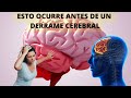 8 Señales que advierten días antes de un DERRAME CEREBRAL si te ocurre llama  al 911 URGENTE!