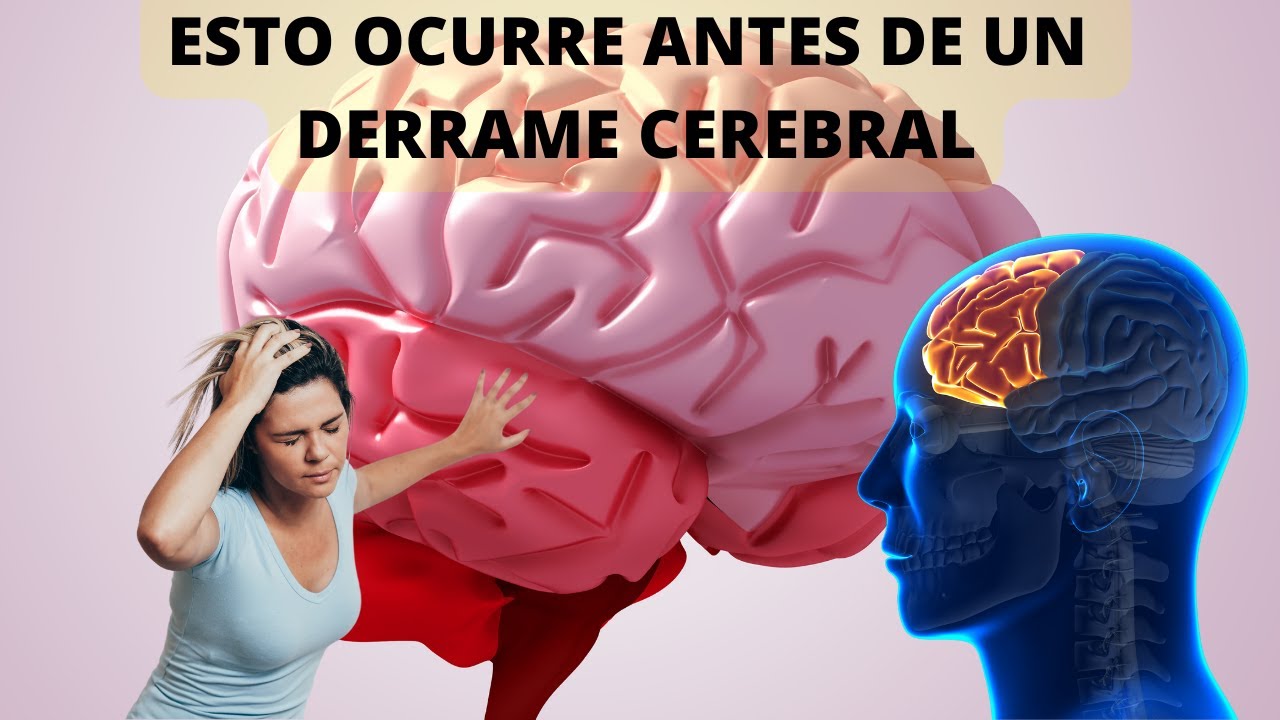 8 Señales que advierten días antes de un DERRAME CEREBRAL si te ocurre ...