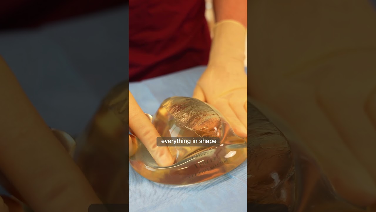 Will a silicone implant leak into your body if it ruptures?