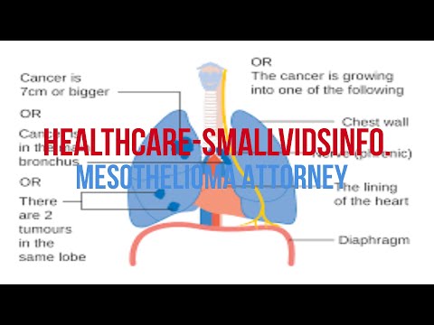 mesothelioma-attorney-|-attorney-for-mesothelioma-|-mesothelioma-trial-attorney