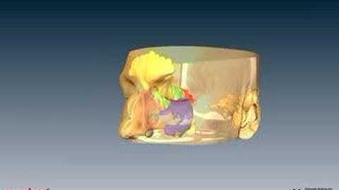 3D visualization of Paranasal Study