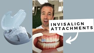 Invisalign Attachments #shorts