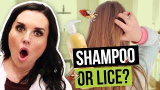 Do I have Lice?...or is it just Shampoo Residue?