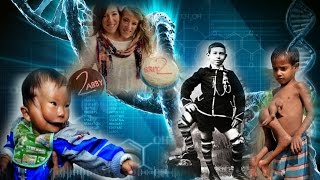 ТОП 5 ЛЮДЕЙ С ЛИШНИМИ ЧАСТЯМИ ТЕЛА ТОП 5 ЛЮДЕЙ С ЛИШНИМИ ЧАСТЯМИ ТЕЛА