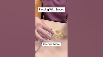 Brace-Friendly Flossing: Tips & Techniques for a Healthier Smile