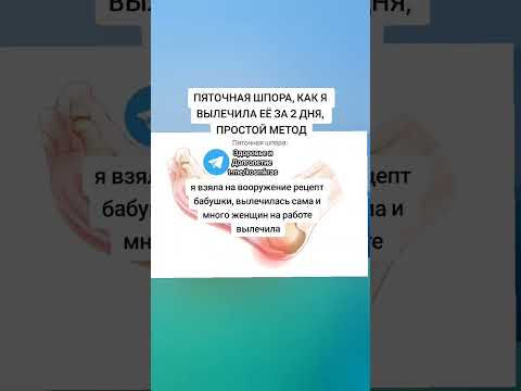ПЯТОЧНАЯ ШПОРА, КАК