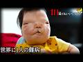 世界に1人だけ。病名がない難病を持つ赤ちゃんに1日密着しました。顔面形成異常で頭蓋骨が欠損【1日見てもいいですか?】/星のミライChannel