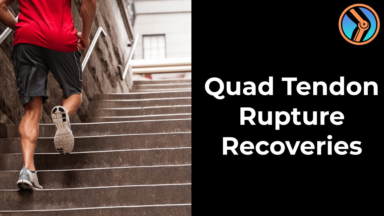 Successful Quadriceps Tendon Rupture Recovery Case Studies YouTube