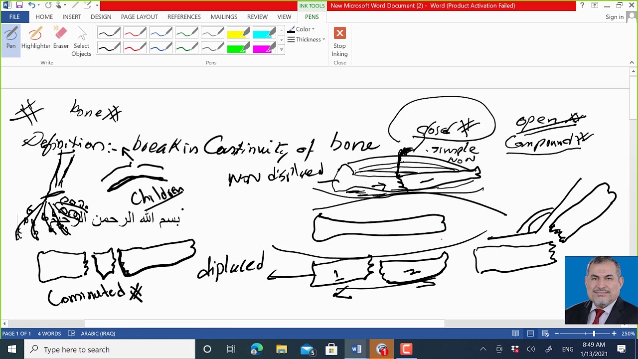 fracture lecture - YouTube