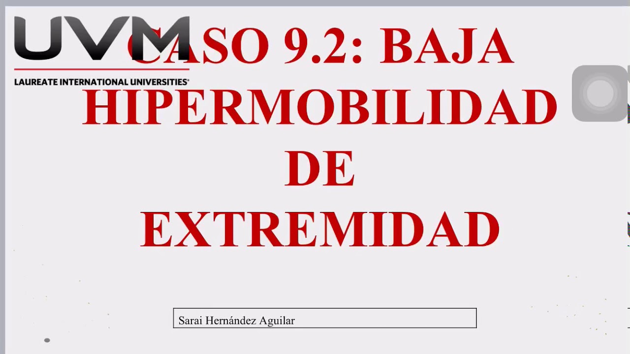 Baja hipermovilidad de extremidad - YouTube
