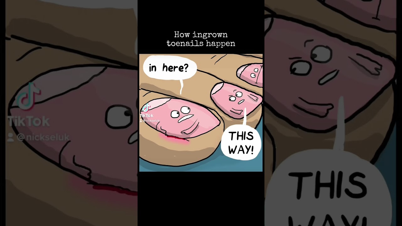 Ingrown toenails by The Awkward Yeti