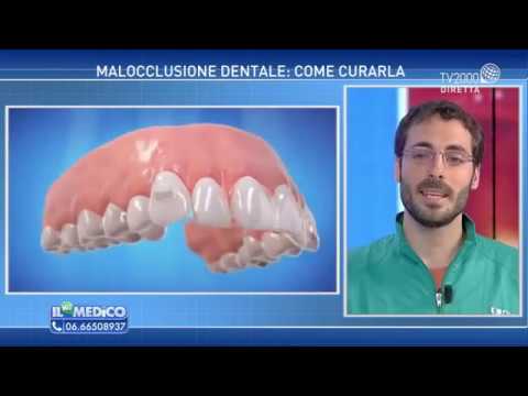 Video: Devono toccarsi i denti superiore e inferiore?