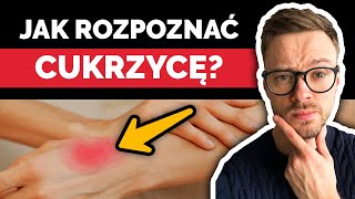 Jaki jest prawidłowy poziom cukru we krwi? Na czczo, rano, po jedzeniu. To już cukrzyca? |Nie słodzę