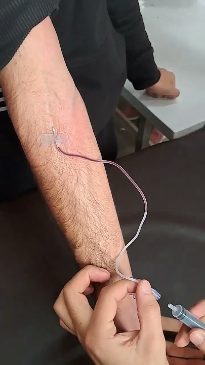 Blood collection by butterfly needle #hospital #medicallaboratory #microscope