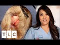 Woman Has A 35 Years Old Cyst On Her Head That She Calls "Bertha" | Dr. Pimple Popper Pop Ups