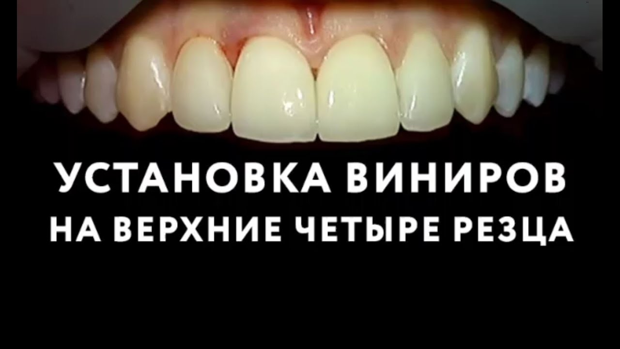 Грм на зуб позже