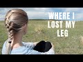 Come to where i lost my leg  became an amputee    cc