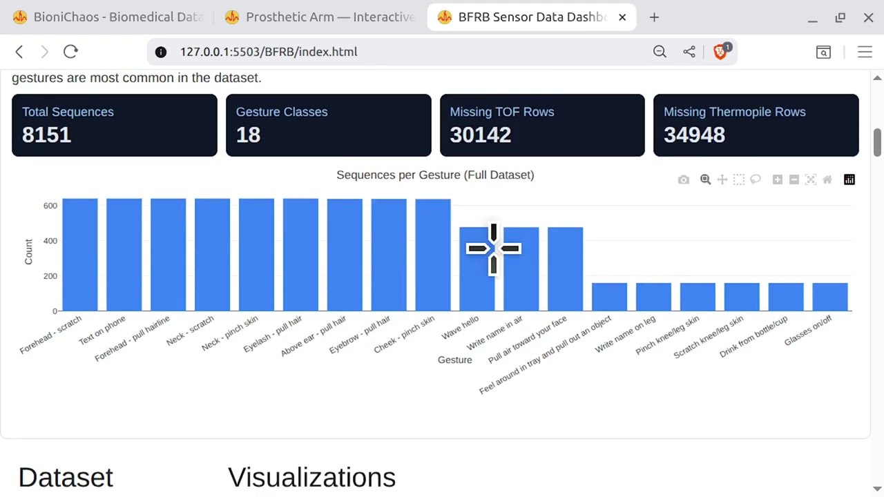 Классификация жестов BFRB: почему носимые устройства с ИИ дают сбои и как очистить данные с помощ...