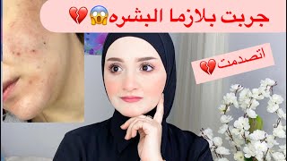 تجربتي مع البلازما للبشره  اتصدمتت😱😱😭😭|| نور سمير 🎀🤍