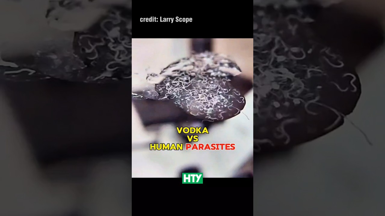 Vodka vs. Parasitic Worms - You Won’t Believe This 🔬