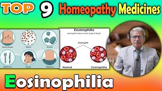 Eosinophilia: Symptoms and #homeopathy medicine -- Dr P S Tiwari