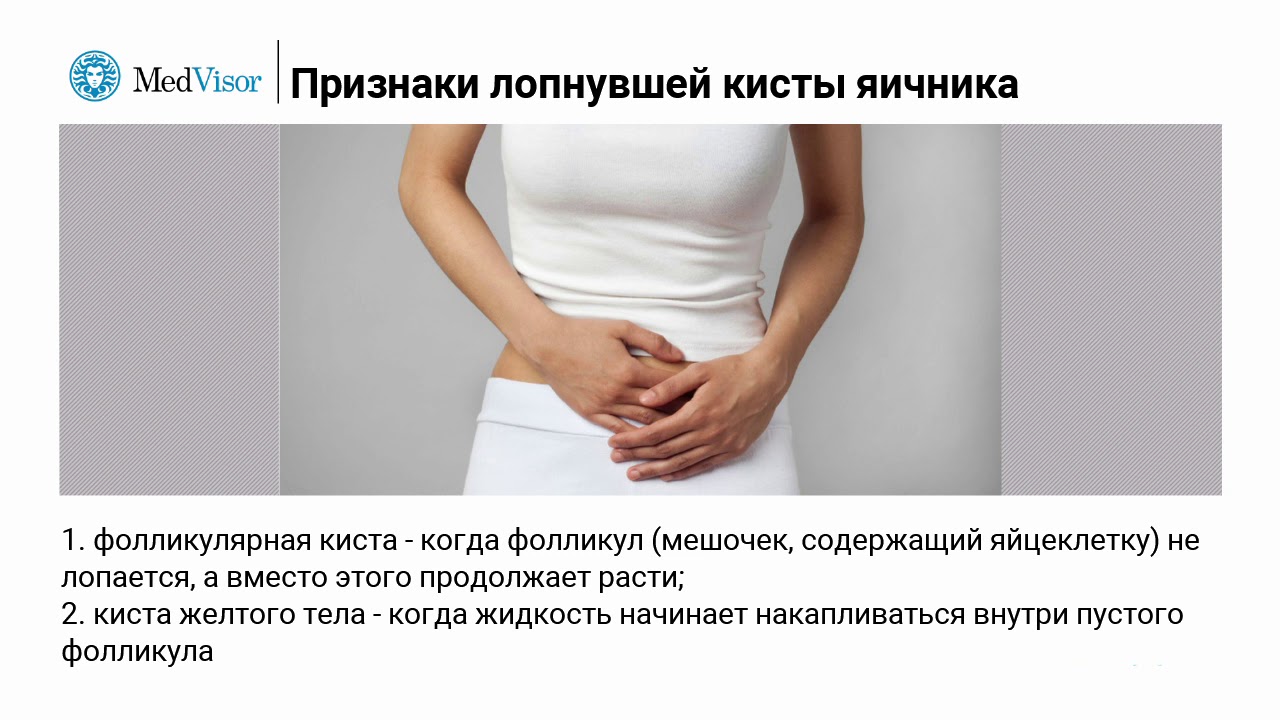 Тянет яичник при беременности на ранних. Правый яичник болит у женщины. Схваткообразные боли в правом яичнике. Если лопнула киста яичника симптомы.