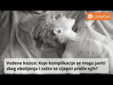 Video: Cjepivo protiv vodenih kozica za odrasle - kada se obavi, nuspojave