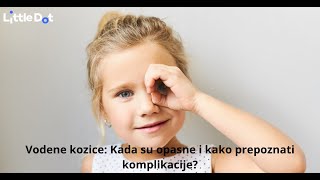 Cijepljenje protiv vodenih kozica – Zašto je važno i kada cijepiti dijete