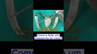 Como é feito o tratamento de canal do dente 13 (canino)