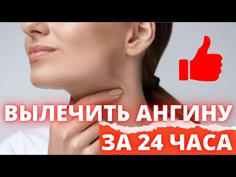 ЛЕЧЕНИЕ АНГИНЫ НАРОДНЫМИ СРЕДСТВАМИ ЗА 24 ЧАСА
